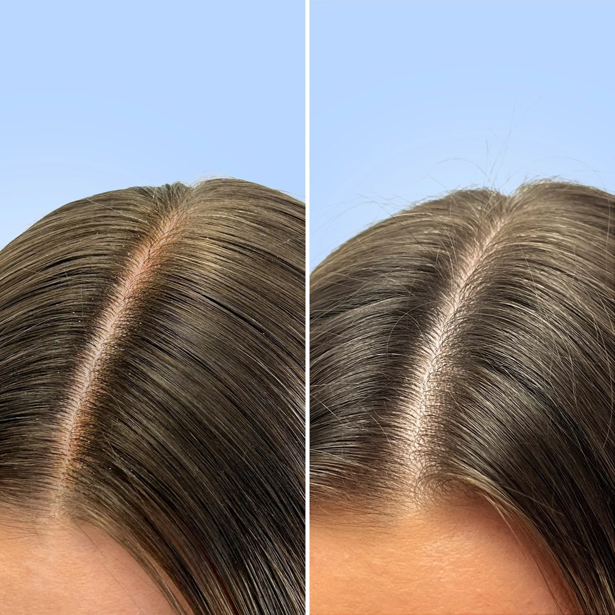 Shampoing clarifiant