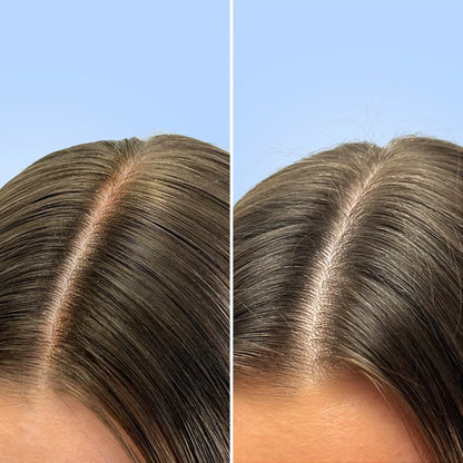 Shampoing clarifiant